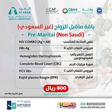 باقة ما قبل الزواج مقيم